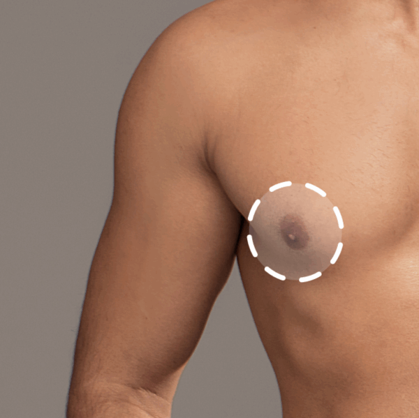 Areola