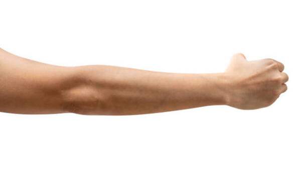 Full arm