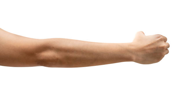Full arm